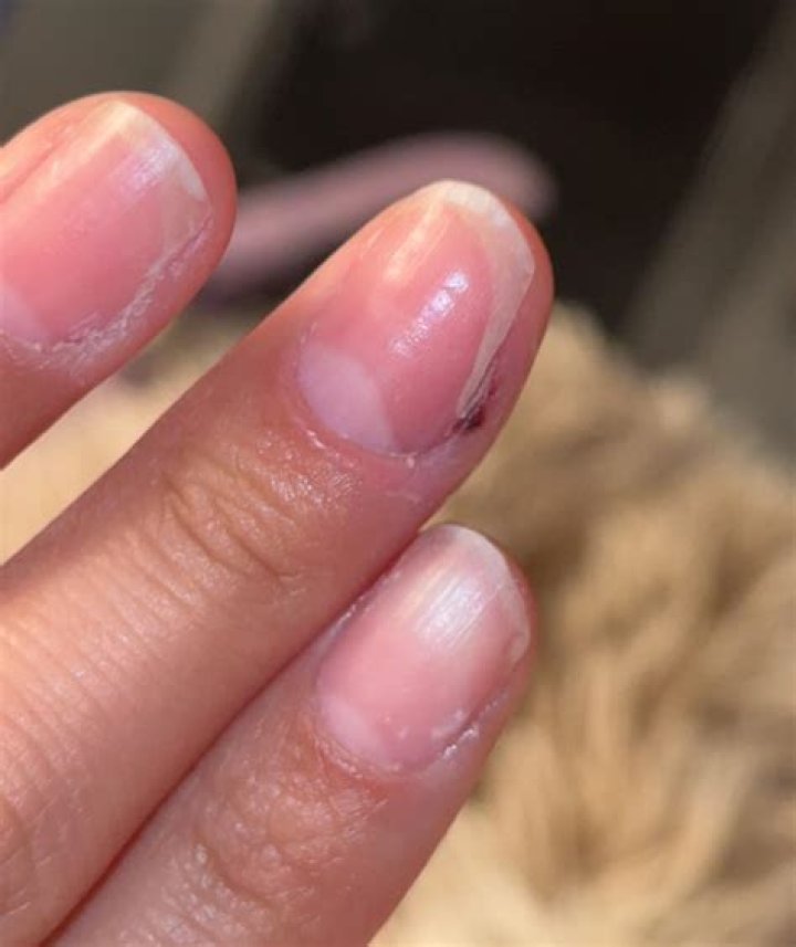 Do my nails need to breathe?