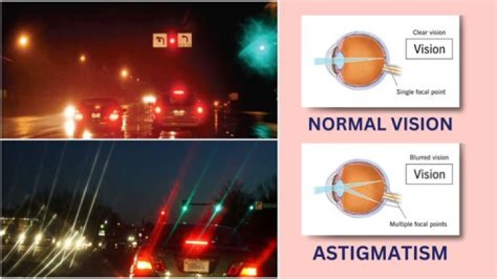 Does astigmatism cause anxiety?