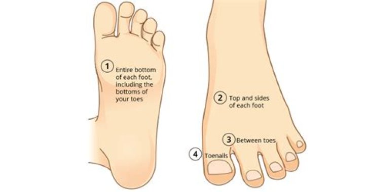 What does a freckle on the bottom of the foot mean?